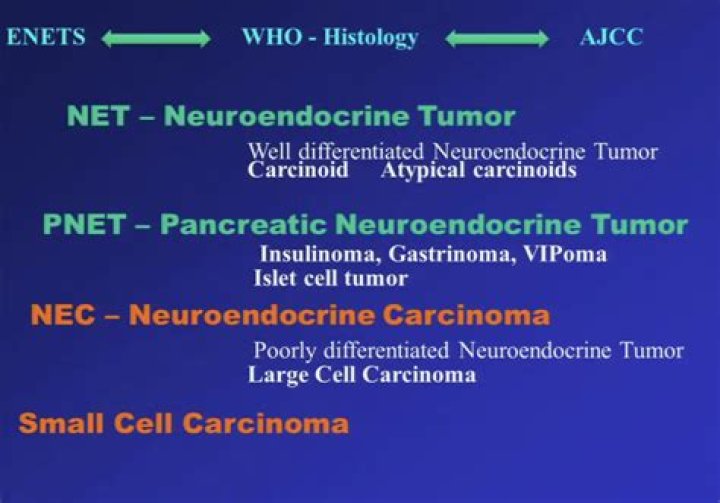 Ipsen : Neuroendocrine Tumor (NET) Expert Call