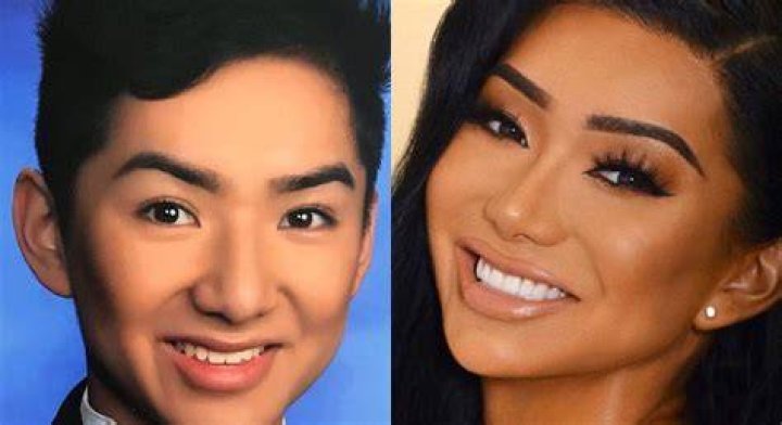 Nikita Dragun before and after plastic surgery photo