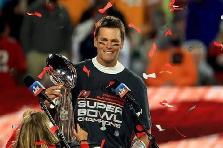 Does Brady have hair transplants? 1 Tom Brady